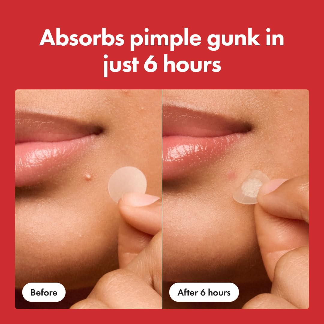 Clear Skin Overnight™ Patch TM